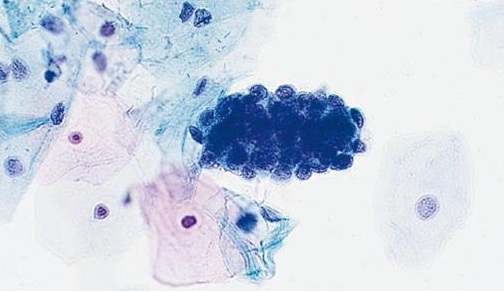 Komorki-endometrialne